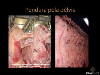 Pendura	
  pela	
  pélvis	
  

 