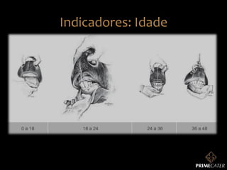 Indicadores:	
  Idade	
  

 
