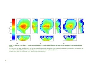 FIGURE 2.5 Local SAR in the head of a 12 year old child exposed to a tri-band mobile phone: (a) 900 MHz, (b) 1800 MHz and (c) 2100 MHz in the cheek
position
The scale is 0 to –60 dB for each frequency, and the data have been normalised with respect to the maximum. The profile is a projection of the maximum SAR
value to illustrate the SAR hotspot. The other two figures are cuts in the two other (orthogonal) planes
(Courtesy of Joe Wiart and Emmanuelle Conil, Orange France Telecom Group)

45

 