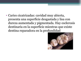 • Caries cicatrizadas: cavidad muy abierta,
presenta una superficie desgastada y lisa con
dureza aumentada y pigmentada. Hay esclerosis
dentinaria en la superficie mientras que existe
dentina reparadora en la profundidad
 
