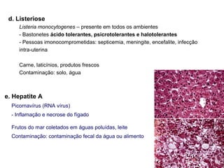 d. Listeriose
Listeria monocytogenes – presente em todos os ambientes
- Bastonetes ácido tolerantes, psicrotolerantes e halotolerantes
- Pessoas imonocomprometidas: septicemia, meningite, encefalite, infecção
intra-uterina
Carne, laticínios, produtos frescos
Contaminação: solo, água
e. Hepatite A
Picornavírus (RNA vírus)
- Inflamação e necrose do fígado
Frutos do mar coletados em águas poluídas, leite
Contaminação: contaminação fecal da água ou alimento
 
