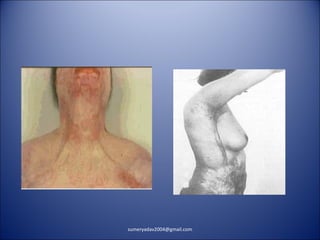 sumeryadav2004@gmail.com
 