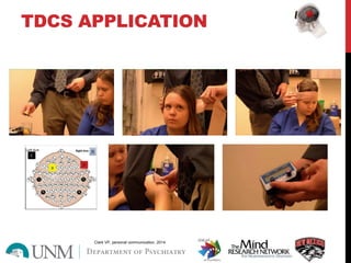 TDCS APPLICATION
Clark VP, personal communication, 2014
 
