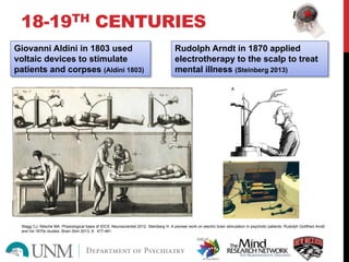 18-19TH CENTURIES
Giovanni Aldini in 1803 used
voltaic devices to stimulate
patients and corpses (Aldini 1803)
Rudolph Arndt in 1870 applied
electrotherapy to the scalp to treat
mental illness (Steinberg 2013)
Stagg CJ, Nitsche MA. Physiological basis of tDCS. Neuroscientist 2012. Steinberg H. A pioneer work on electric brain stimulation in psychotic patients: Rudolph Gottfried Arndt
and his 1870s studies. Brain Stim 2013; 6: 477-481.
 