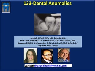 133-Dental Anomalies
Awatef SHAAR (BAU-LB), Orthodontist.
Mohamad ABOULNASER- Orthodontist, BAU, Connecticut, USA.
Oussama SANDID- Orthodontist, D.C.D., D.U.O, C.E.S.B.B, C.E.S.O.D.F ,
S.Q.O.D.F, Paris. France.
Contact: dr.aboualnaser@hotmail.com
www.orthofree.com
 