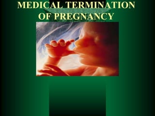 MEDICAL TERMINATION
OF PREGNANCY
 
