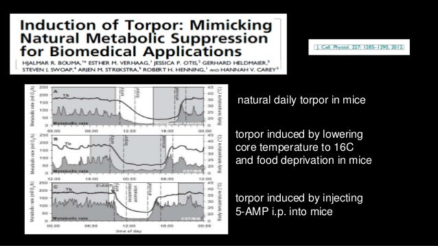 Suspended Animation By Mervyn Singer
