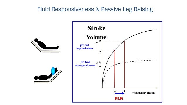 Rob Mac Sweeney vs Paul Marik Predicting Fluid Rob Mac Sweeney vs Paul Marik Predicting Fluid