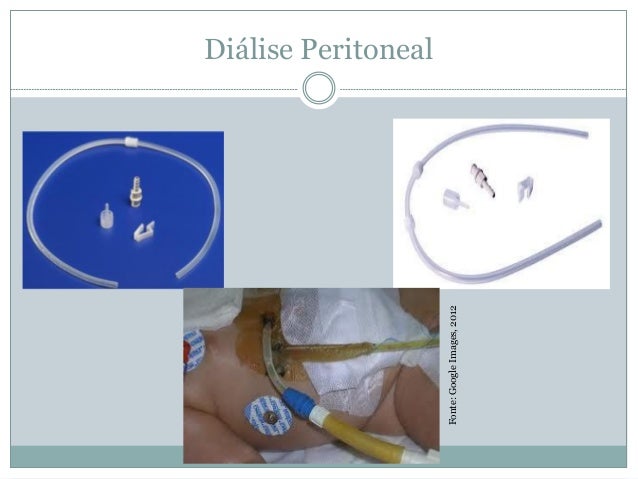 134491411 cuidados-de-enfermagem-ao-paciente-dialitico