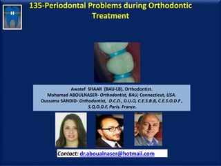 135-Periodontal Problems during Orthodontic
Treatment
Awatef SHAAR (BAU-LB), Orthodontist.
Mohamad ABOULNASER- Orthodontist, BAU, Connecticut, USA.
Oussama SANDID- Orthodontist, D.C.D., D.U.O, C.E.S.B.B, C.E.S.O.D.F ,
S.Q.O.D.F, Paris. France.
Contact: dr.aboualnaser@hotmail.com
www.orthofree.com
 