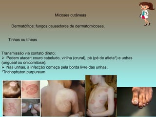 1358-doença causadas por fungos marcia.pdf