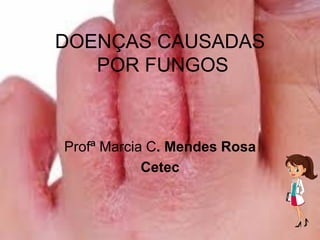 DOENÇAS CAUSADAS
POR FUNGOS
Profª Marcia C. Mendes Rosa
Cetec
 