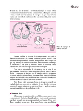 P OFAE
R
do com esse tipo de dreno é a correta manutenção do vácuo, obtido
com a compressão do reservatório. Caso contrário, a drenagem não será
eficaz, podendo ocorrer acúmulo de secreção - o que provocaria no
cliente dor, desconforto e alterações dos seus sinais vitais, entre outras
intercorrências.
Hematoma subdural
Orifícios
Tubo de drenagem

Seção da porção intracraniana
do tubo de drenagem

Reservatório
Válvula anti-refluxo

100-CC
75
50
25

Dreno de aspiração de
Jackson-Pratt (JP)

Existem também os sistemas de drenagem aberta, nos quais o
dreno mais utilizado é o de Penrose, constituído por um tubo macio de
borracha, de largura variada, utilizado principalmente para cirurgias em
que haja presença de abcesso na cavidade, particularmente nas cirurgias abdominais – nas quais se posiciona dentro da cavidade, sendo
exteriorizado por um orifício próximo à incisão cirúrgica.
Com relação aos cuidados de enfermagem, por se tratar de um
sistema aberto - que deverá estar sempre protegido por um reservatório
(bolsa) - a manipulação deve ser feita de maneira asséptica, pois existe
a comunicação do meio ambiente com a cavidade, o que possibilita a
ocorrência de infecção – e o profissional deve estar atento para a possibilidade de exteriorização, o que não é incomum.
Além dessas, existe uma outra forma de drenagem que pode ser
realizada tanto no momento da realização do ato cirúrgico como na
presença de algum colapso: a drenagem de tórax – a qual, em vista de
suas particularidades, será detalhada a seguir.
!

Dreno de tórax

Sabemos que os pulmões estão envolvidos por um saco seroso,
completamente fechado, chamado pleura - que possui um espaço
(cavidade pleural) com pequena quantidade de líquido. Nesta cavidade a pressão é menor que a do ar atmosférico, o que possibilita a
59

 