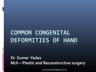 Dr Sumer Yadav
Mch – Plastic and Reconstructive surgery
sumeryadav2004@gmail.com
 