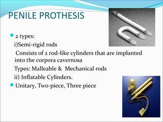 Semi Rigid Rod sexual-arousal-disorders | PPT