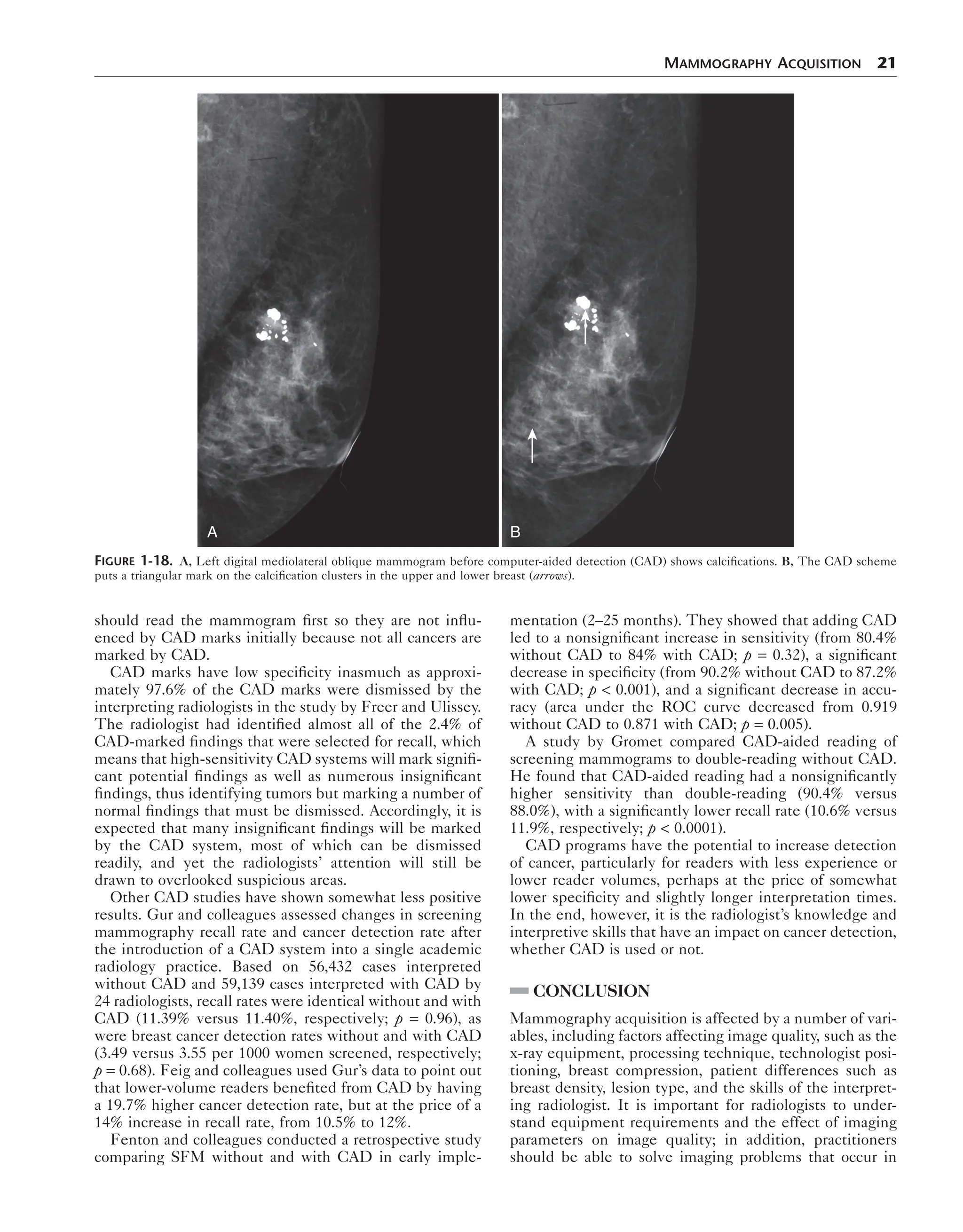 Breast Imaging The Requisites 2nd Edition Debra Ikeda Md | PDF