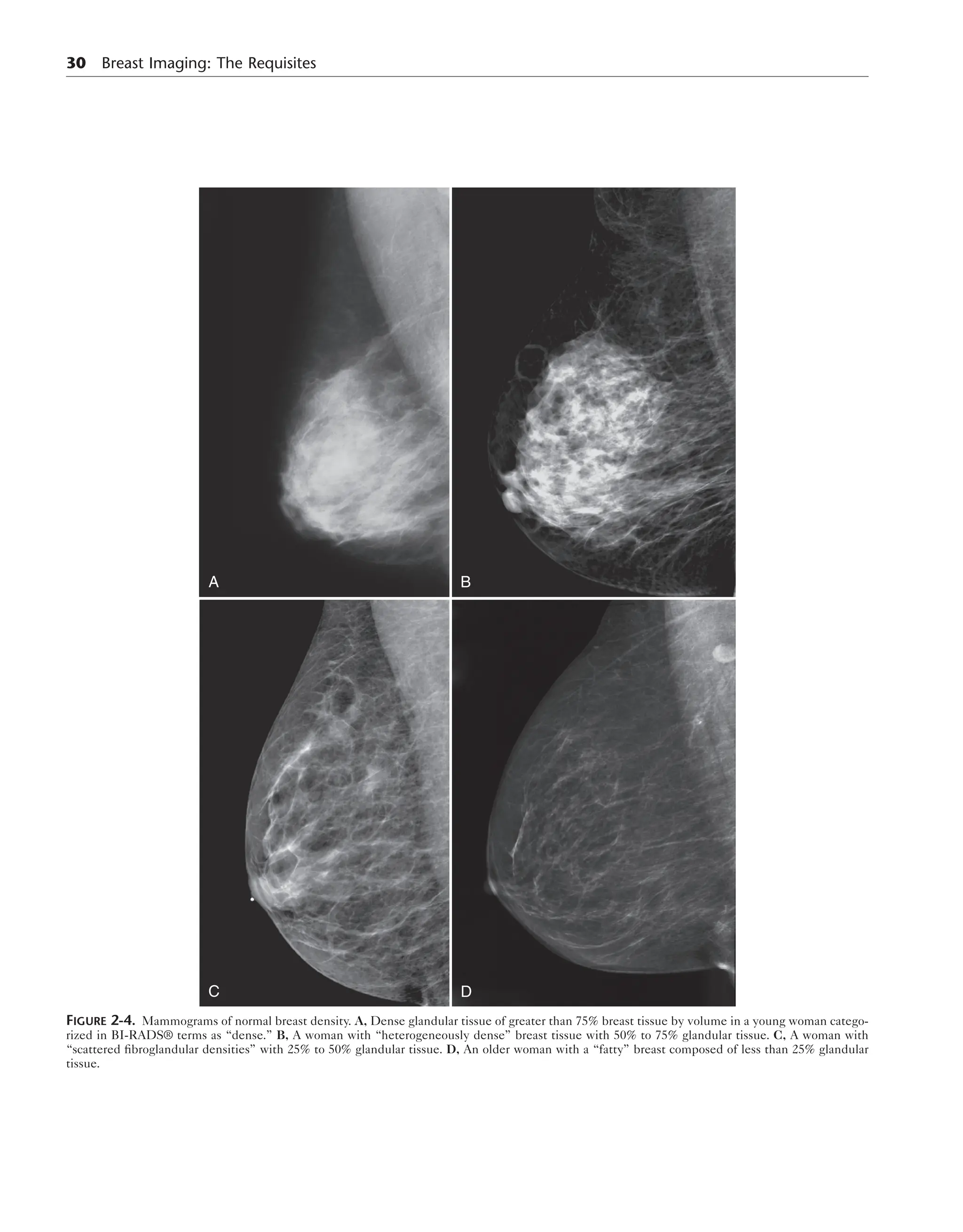 Breast Imaging The Requisites 2nd Edition Debra Ikeda Md | PDF