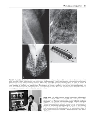 Breast Imaging The Requisites 2nd Edition Debra Ikeda Md | PDF