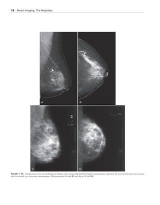 Breast Imaging The Requisites 2nd Edition Debra Ikeda Md | PDF