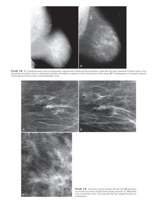 Breast Imaging The Requisites 2nd Edition Debra Ikeda Md | PDF