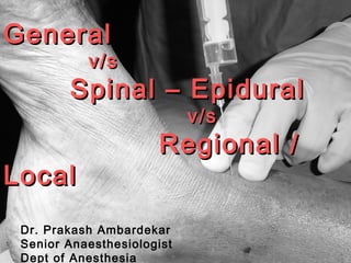 GeneralGeneral
v/sv/s
Spinal – EpiduralSpinal – Epidural
v/sv/s
Regional /Regional /
LocalLocal
Dr. Prakash Ambardekar
Senior Anaesthesiologist
Dept of Anesthesia
 
