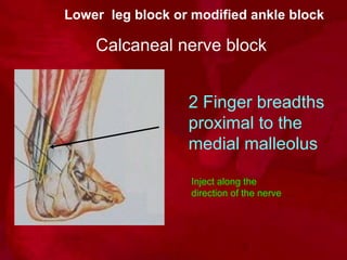 Lesser Toe Block 1362566341 surgical treatment of diabetic foot | PPT