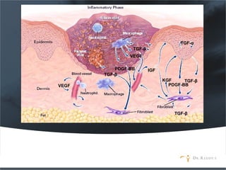 TGF-β
PDGF-BB
VEGF
TGF-β
VEGF
PDGF-BB
TGF-β
IGF
TGF-βKGF
TGF-α
 