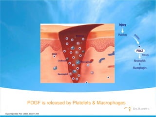 Expert Opin.Biol Ther. (2002) 2(2):211-218
PDGF is released by Platelets & Macrophages
 