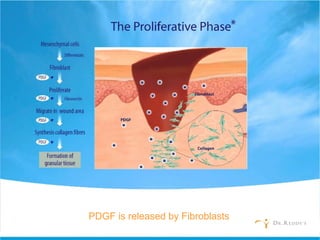 PDGF is released by Fibroblasts
 