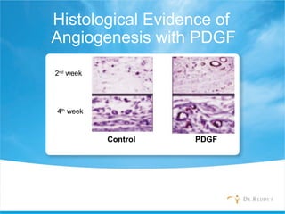 Histological Evidence of
Angiogenesis with PDGF
2nd
week
4th
week
Control PDGF
 