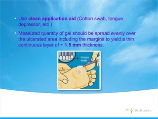 • Use clean application aid (Cotton swab, tongue
depressor, etc )
• Measured quantity of gel should be spread evenly over
the ulcerated area including the margins to yield a thin
continuous layer of ~ 1.5 mm thickness.
 