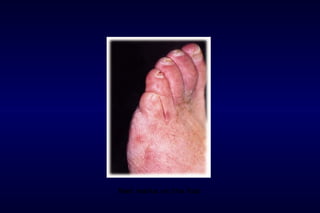 Red marks on the foot
 