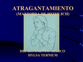 ATRAGANTAMIENTO
(MANIOBRA DE HEIMLICH)
DEPARTAMENTO MEDICO
HYLSA TERNIUM
 