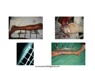 sumeryadav2004@gmail.com
 