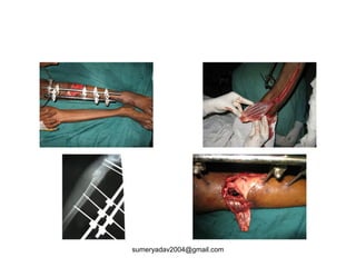 sumeryadav2004@gmail.com
 