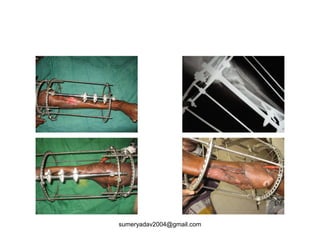 sumeryadav2004@gmail.com
 