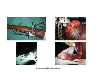 sumeryadav2004@gmail.com
 