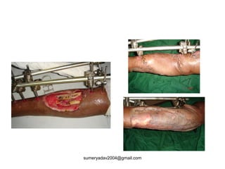 sumeryadav2004@gmail.com
 