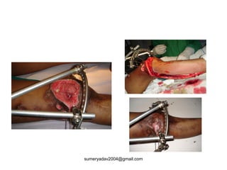 sumeryadav2004@gmail.com
 