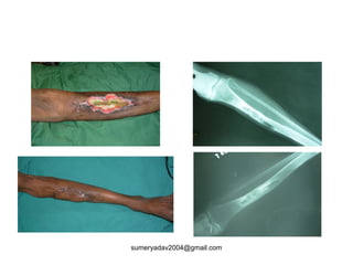 sumeryadav2004@gmail.com
 