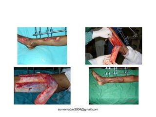 sumeryadav2004@gmail.com
 