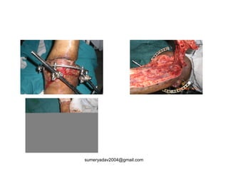 sumeryadav2004@gmail.com
 