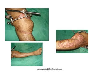 sumeryadav2004@gmail.com
 