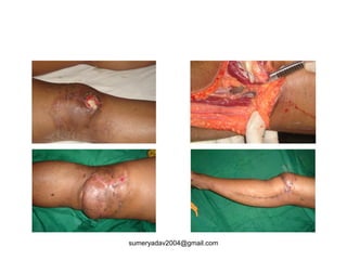 sumeryadav2004@gmail.com
 