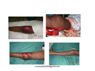 sumeryadav2004@gmail.com
 