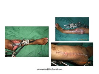 sumeryadav2004@gmail.com
 