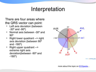 Interpretation
There are four areas where
the QRS vector can point:
• Left axis deviation (between
  -30º and -90º)
• Normal axis between -30º and
  90º
• Right lower quadrant --> right
  axis deviation (between 90º
  and -180º)
• Right upper quadrant -->
  extreme right axis
  deviation(between -90º and
  -180º)


                                   more about this topic on ECGpedia...
 