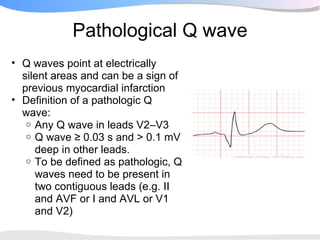 Pathological Q wave
• Q waves point at electrically
  silent areas and can be a sign of
  previous myocardial infarction
• Definition of a pathologic Q
  wave:
   o Any Q wave in leads V2–V3
   o Q wave ≥ 0.03 s and > 0.1 mV
     deep in other leads.
   o To be defined as pathologic, Q
     waves need to be present in
     two contiguous leads (e.g. II
     and AVF or I and AVL or V1
     and V2)
 