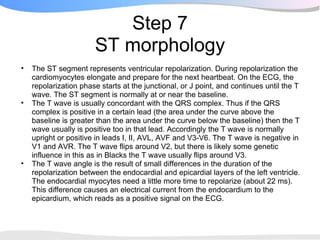 Step 7
                       ST morphology
•   The ST segment represents ventricular repolarization. During repolarization the
    cardiomyocytes elongate and prepare for the next heartbeat. On the ECG, the
    repolarization phase starts at the junctional, or J point, and continues until the T
    wave. The ST segment is normally at or near the baseline.
•   The T wave is usually concordant with the QRS complex. Thus if the QRS
    complex is positive in a certain lead (the area under the curve above the
    baseline is greater than the area under the curve below the baseline) then the T
    wave usually is positive too in that lead. Accordingly the T wave is normally
    upright or positive in leads I, II, AVL, AVF and V3-V6. The T wave is negative in
    V1 and AVR. The T wave flips around V2, but there is likely some genetic
    influence in this as in Blacks the T wave usually flips around V3.
•   The T wave angle is the result of small differences in the duration of the
    repolarization between the endocardial and epicardial layers of the left ventricle.
    The endocardial myocytes need a little more time to repolarize (about 22 ms).
    This difference causes an electrical current from the endocardium to the
    epicardium, which reads as a positive signal on the ECG.
 