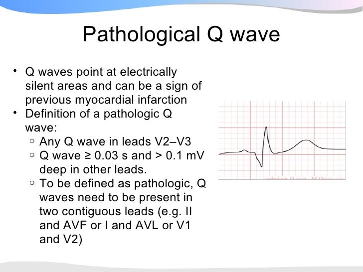 ecgpedia-ecg-presentation